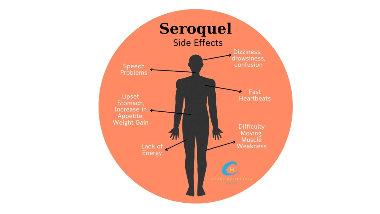 Seroquel for Anxiety Disorder