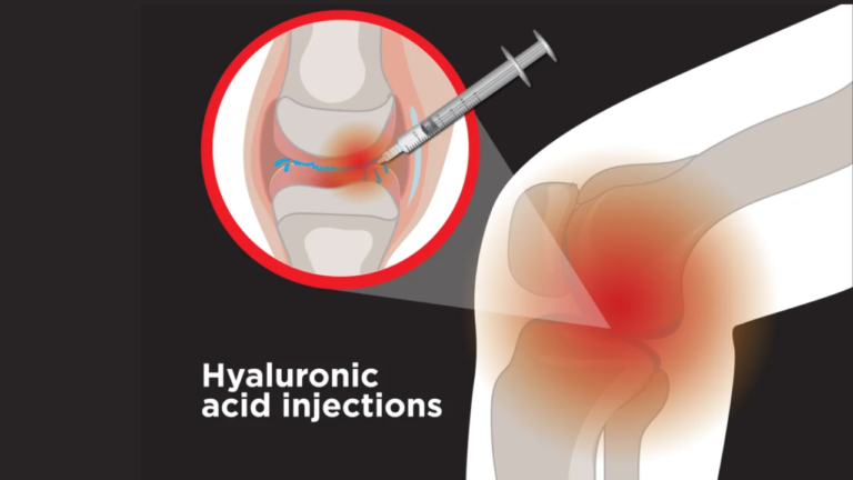 Revitalize Your Knee